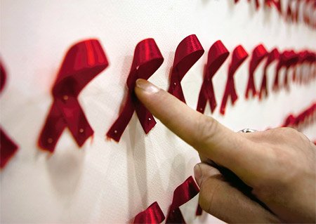 Что такое СПИД и как его вылечить